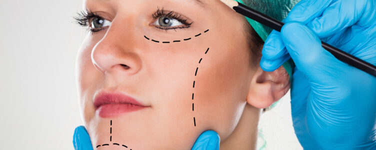 Close-up Of A Surgeon Drawing Perforation Lines On Young Woman's Face